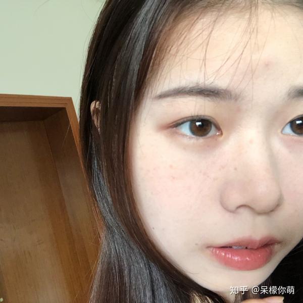 各位觉得长雀斑的女孩子怎么样呀?