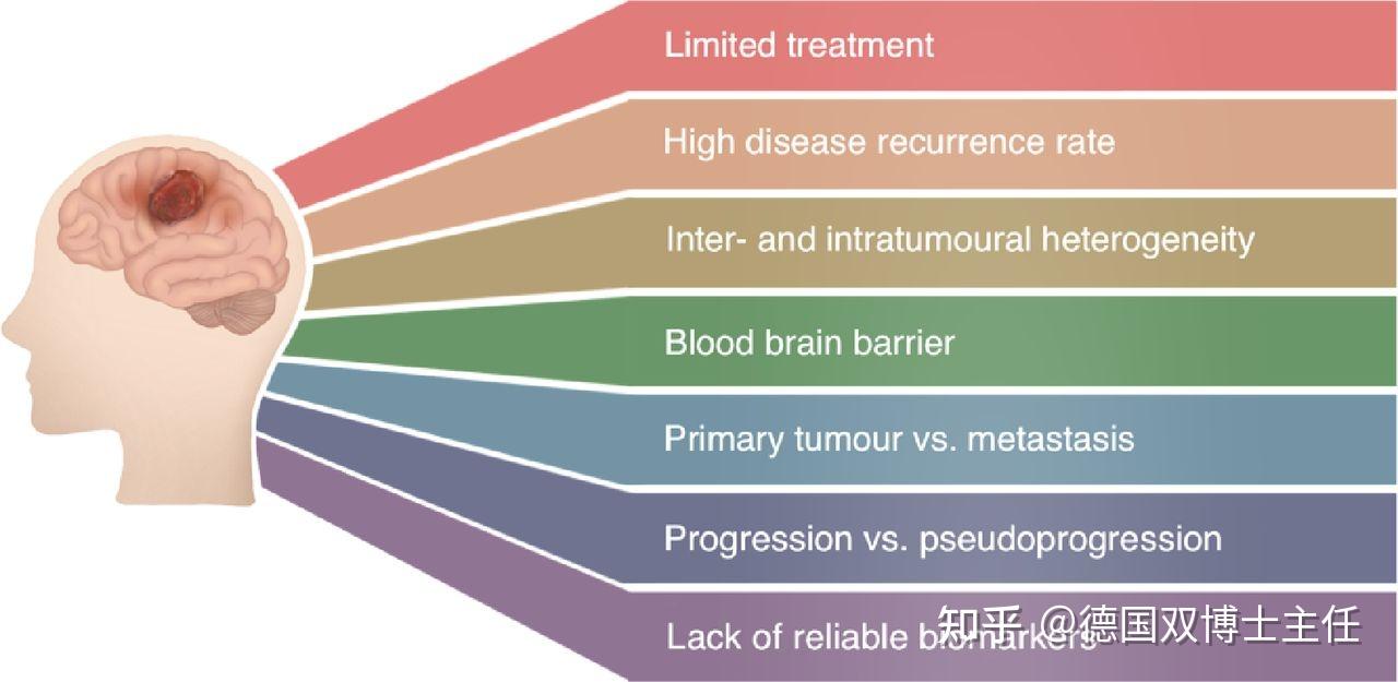 胶质母细胞瘤4级生存期超过20年常见吗 知乎