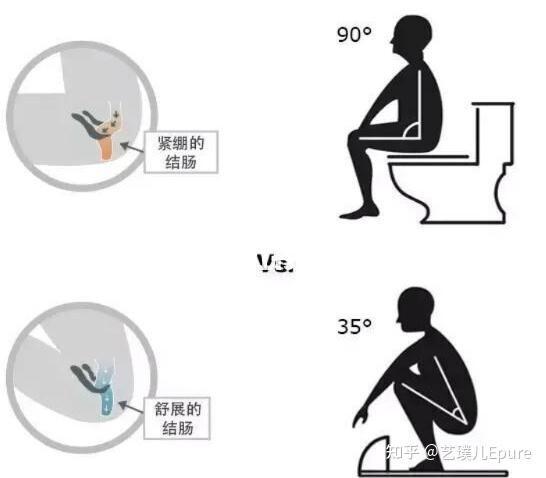 因此, 在进行瓦氏动作的时候,我们会出现短暂的血压上升,心率下降的