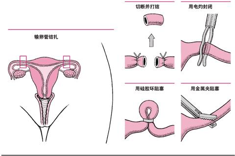 险怀孕 怀孕期间可以买险吗