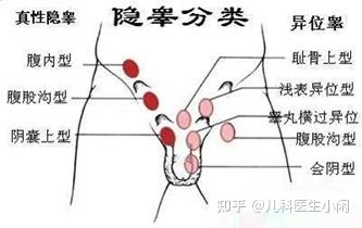 孩子的"蛋蛋"去哪了?