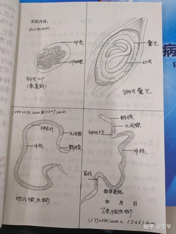 华支睾吸虫卵,姜片虫卵,肺吸虫卵,日本血吸虫卵