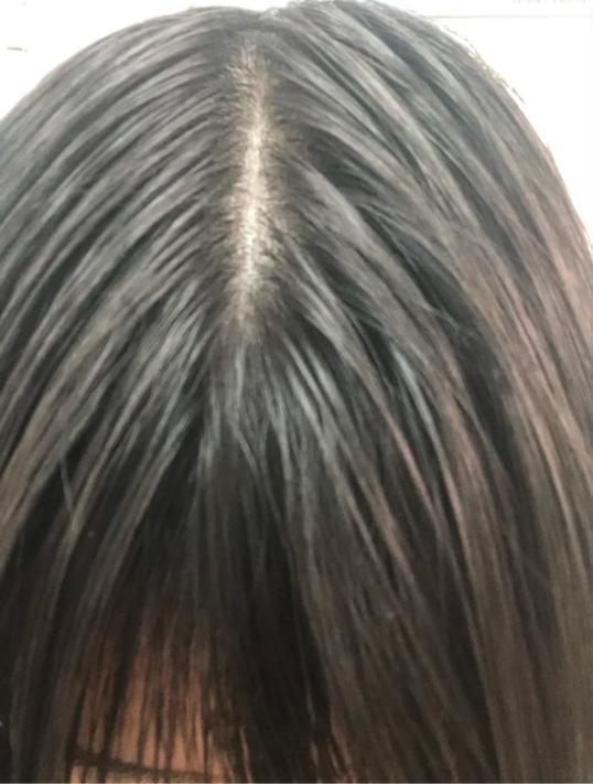 头发细软塌超爱油怎么护理头发让头顶看起来蓬松