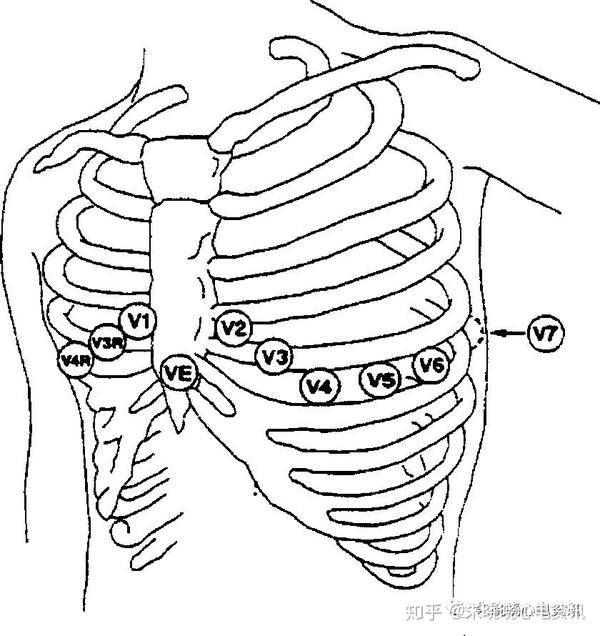 山羊老师心电图机记录要点