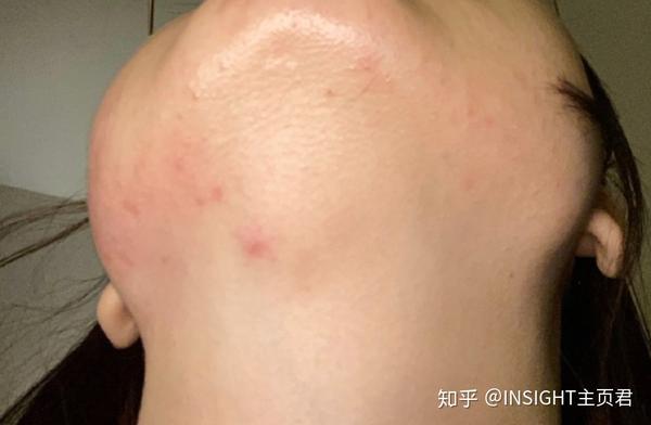 图片均为入住酒店的同学们提供 因为l同学对灰尘过敏, 在进入该房间不