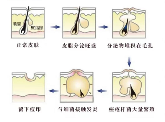 糖化自检出现这些现象你的肌肤已经被糖化了