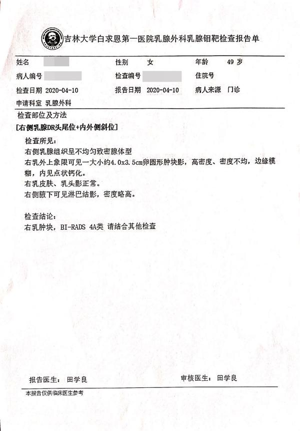 乳腺钼靶检查