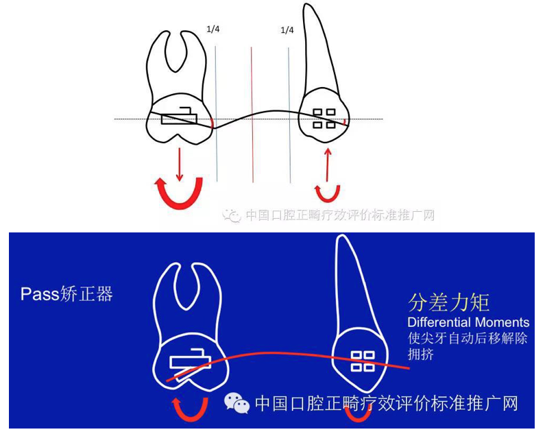 如何评价北大口腔正畸科许天民教授的生理性支抗技术