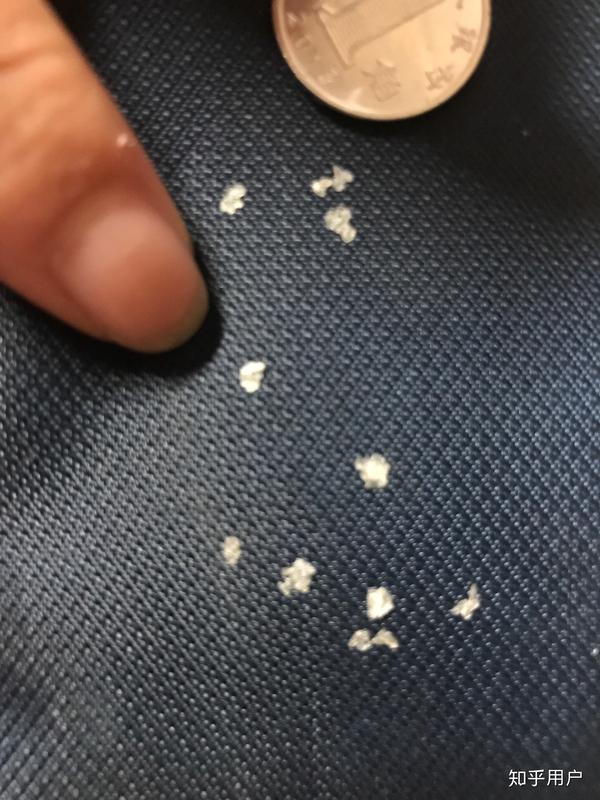 见过的最大头皮屑多大?