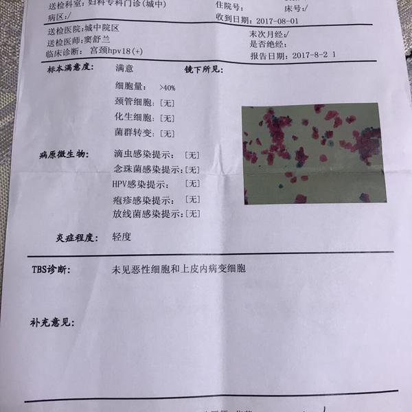 tct显示上皮内低度病变,hpv检查结果高危型:39型阳性,建议阴道镜活检?