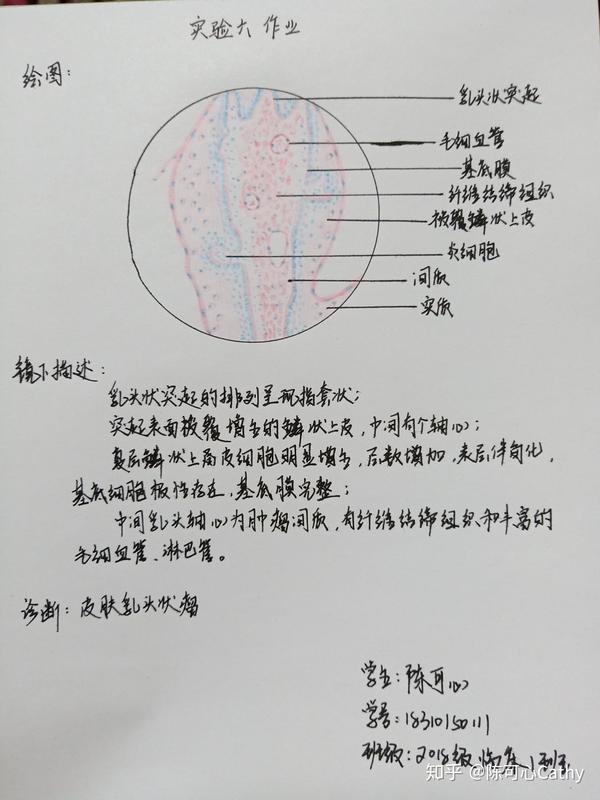 发完就清相册啦~ 有不妥的地方还希望大家指正  一,肝细胞水肿 最后