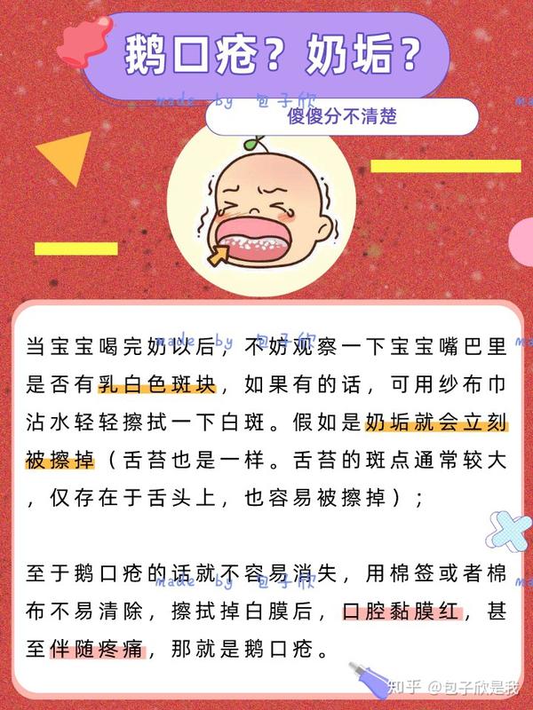 心疼宝宝得了鹅口疮只因妈妈犯了这个错