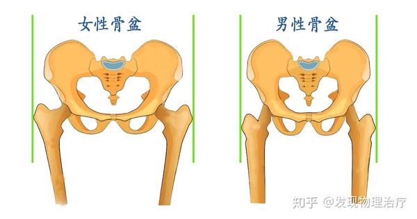 女性骨盆相比男性更宽,股骨头也更加往外凸出