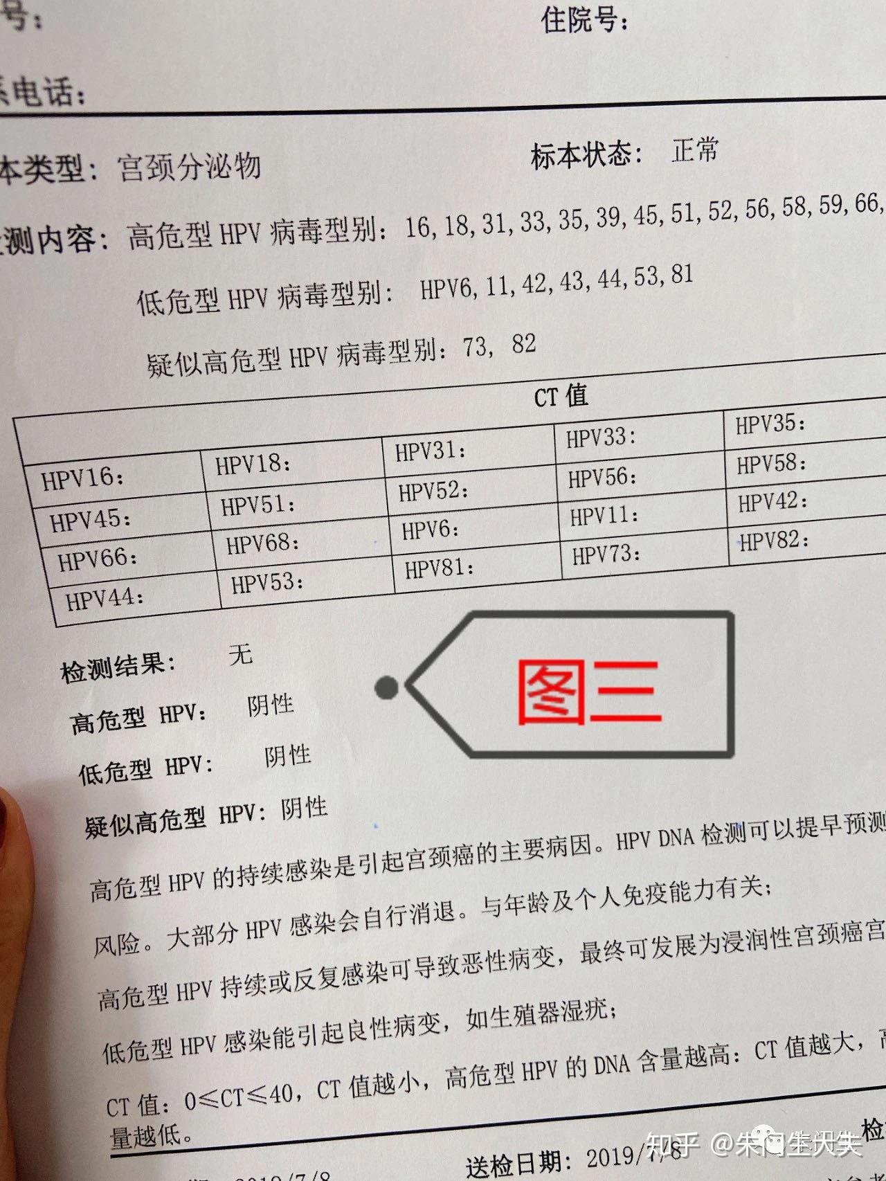 hpv59 zhuanlan.zhihu.com