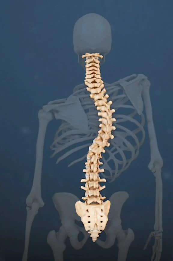 脊柱侧弯施罗斯体操生理逻辑训练,每天15分钟纠正腰部