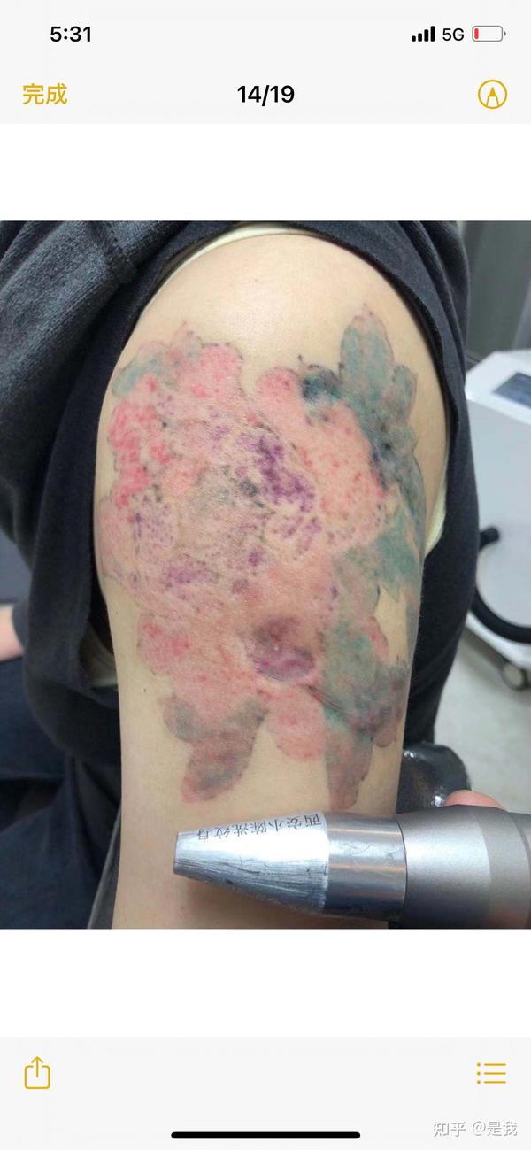 洗纹身找对人真的能洗干净