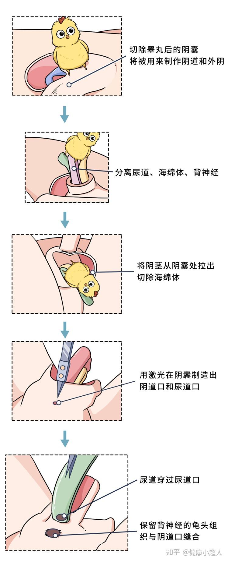 女生居然也能体验勃起的感觉