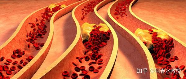 血液成分异常性血管炎 由于血液中某些成分异常引起的细小血管炎性