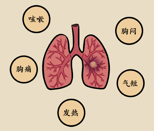 烟龄十年和二十年对肺部的影响大吗?