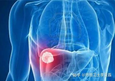 肝脏弥漫性改变是什么意思?