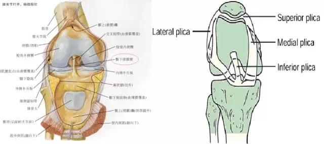 大家膝盖髌下脂肪垫炎都是如何痊愈的