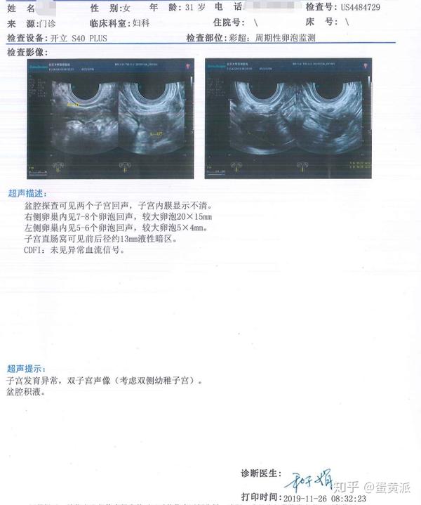 幼稚子宫,amh值3.68 选择乌克兰dy