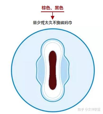 月经里的健康信号,每个女生都应该知道!