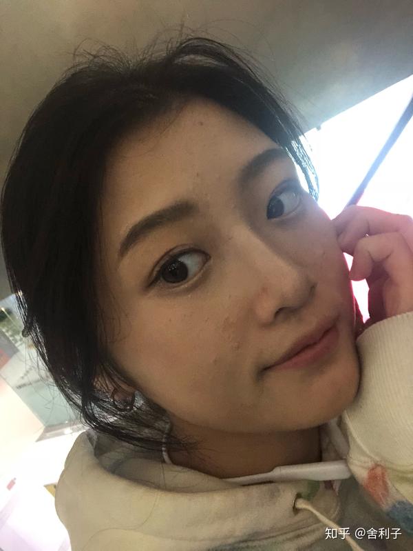 好了……看看真实的样子吧 以下内容可能引起不适 苹果原相机 未修