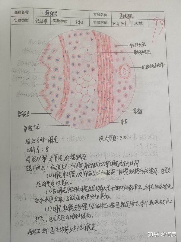 病理实验红蓝铅笔绘图