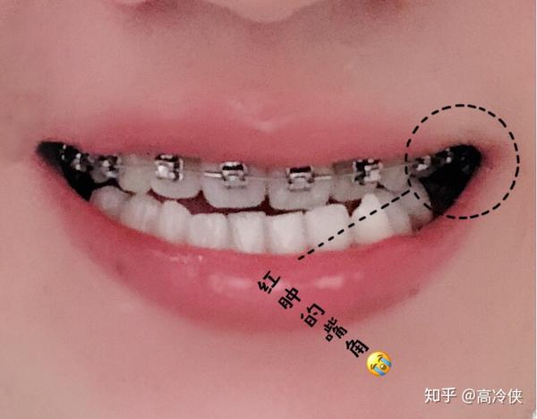 反颌手术图片大全 Uc今日头条新闻网