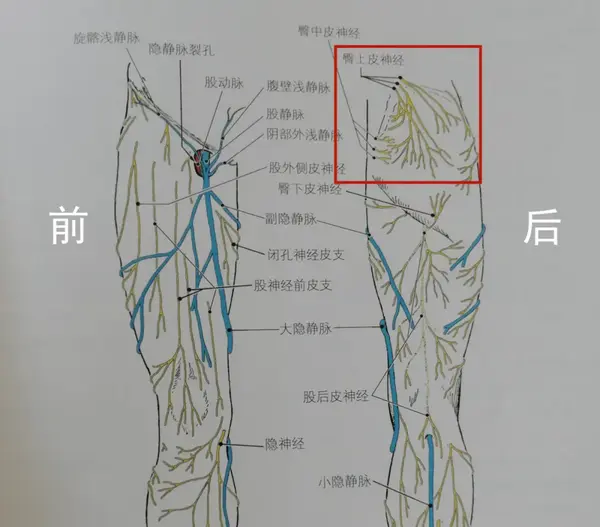 臀上皮神经卡压综合征 臀上皮神经炎又称臀上皮神经损伤,臀上皮神 