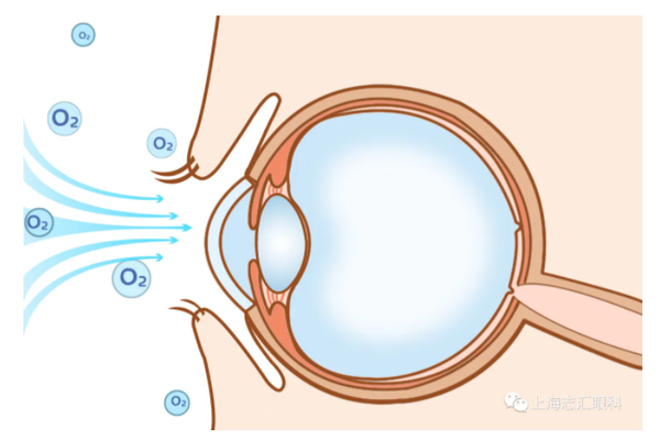 闭眼状态时角膜所需的氧气 70%来自睑结膜血管(剩下10-15%来自角巩膜