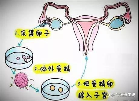 试管婴儿是将男方精子和女方卵子都取出来,在体外,实验室培养皿内进行