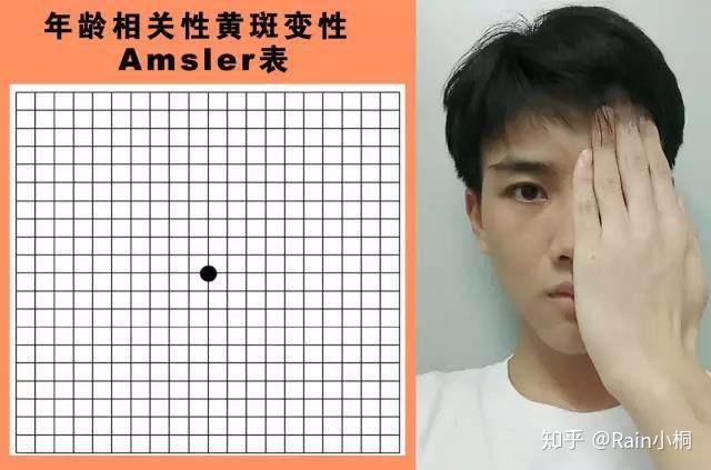 简单有效的自测方法:老年性黄斑病变的具体病因尚不明确,可能与下列