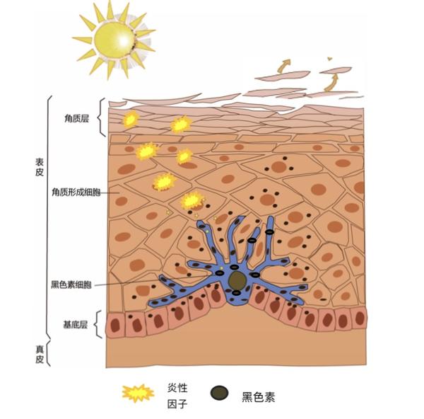 线——自由基——炎症因子——黑色素细胞——黑色素——迁移——剥脱