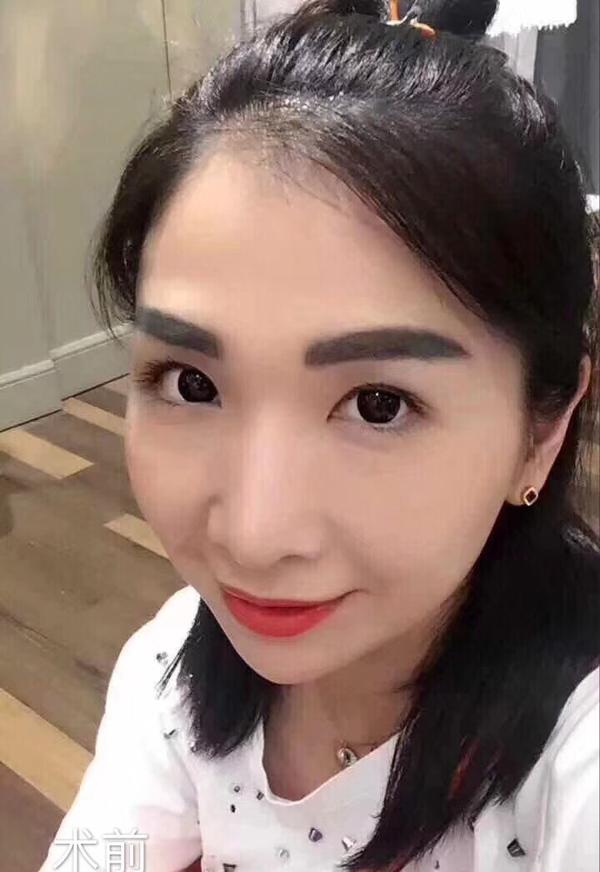 半永久纹眉两年还没掉色怎么办?
