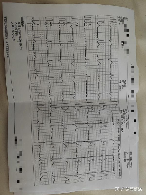 最近胸闷气短下面是心电图能看看是因为什么嘛