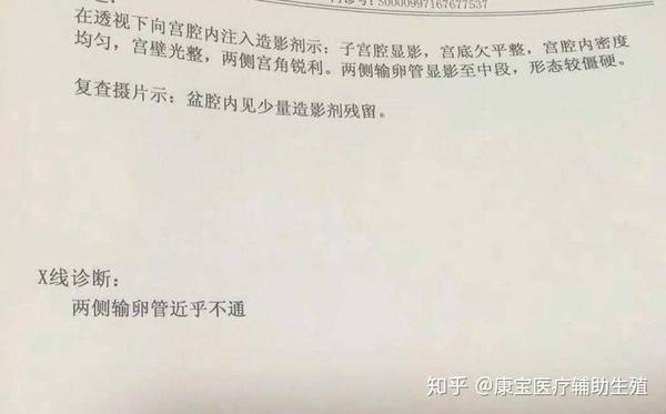 曾纪琪输卵管不通的诊断书