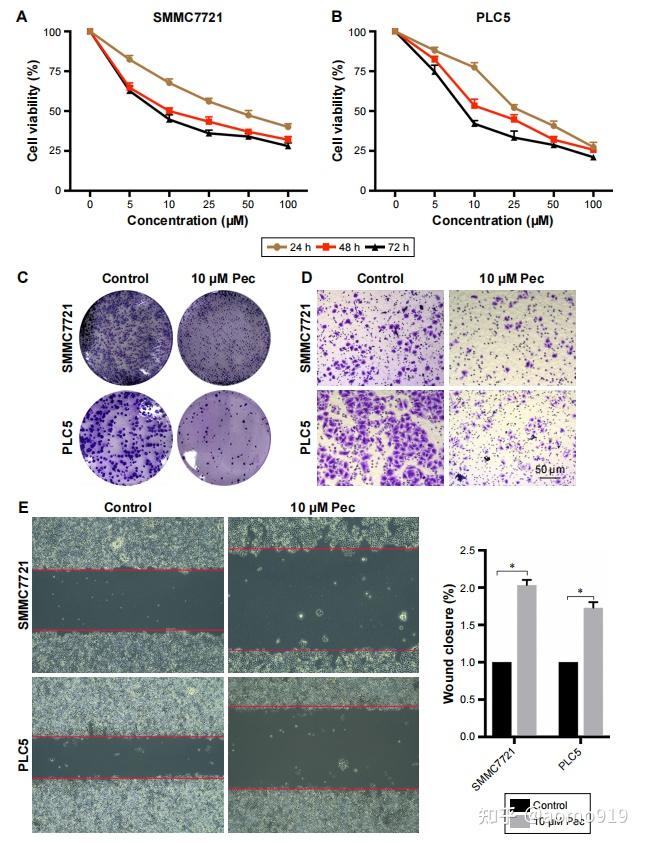 cck8结果表明,pectolinarigenin以时间和剂量依赖性的方式显著延缓