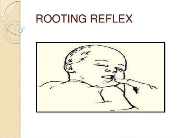 觅食反射(rooting reflex)       该反射缺失预示较严重的病理现象