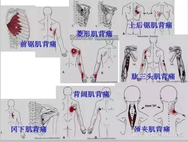 人体肌肉的疼痛扳机点全身肌肉放松按压流程图