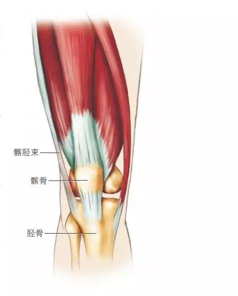 遭遇了「髂胫束综合征」该怎么办?