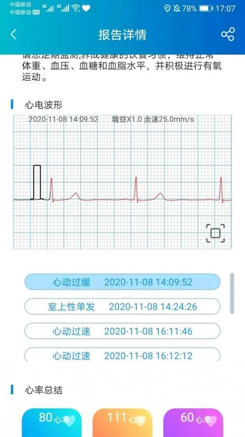 网友测评对比hipee心电仪vs粒恩心电