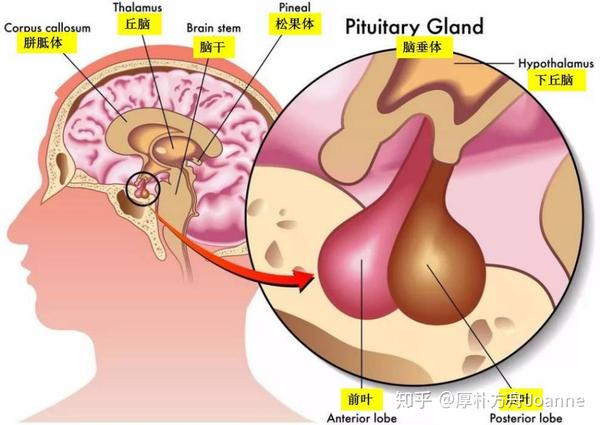 常困扰年轻人的脑垂体瘤该如何治疗