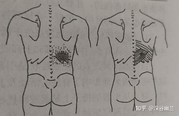 后上锯肌自我牵张法:坐于低位沙发,双手从外侧方抓住双膝,尽力向后弓