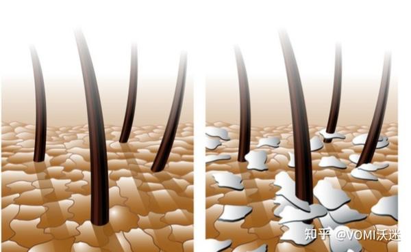 头皮健康与微生态的关系 知乎