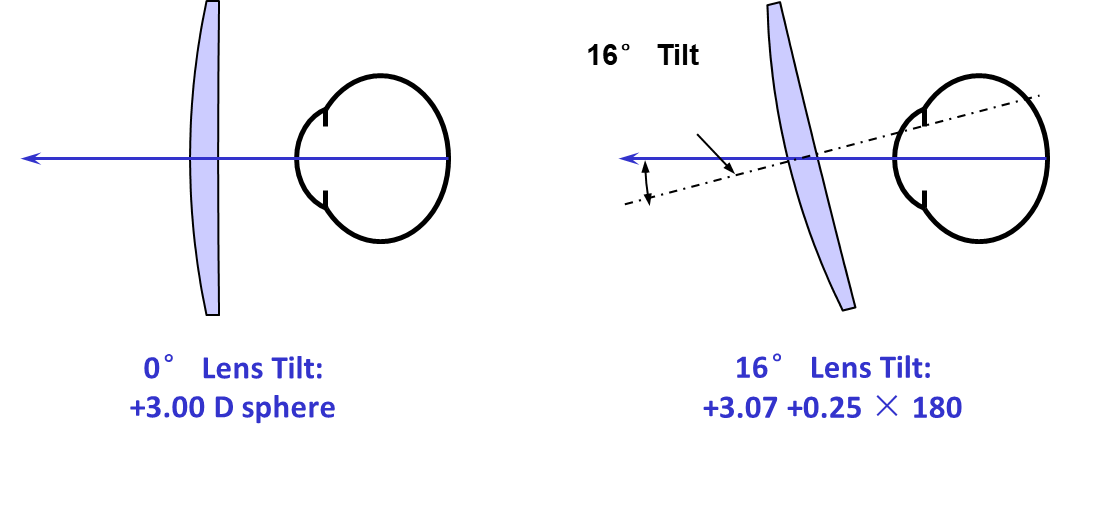 给大家一点定量的概念:倾斜角倾斜16度可能带来7度的变化以及25度散光