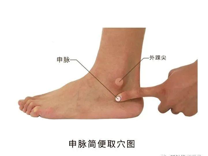 腰间盘突出该如何针灸专家亲自演示教你如何选穴和进针