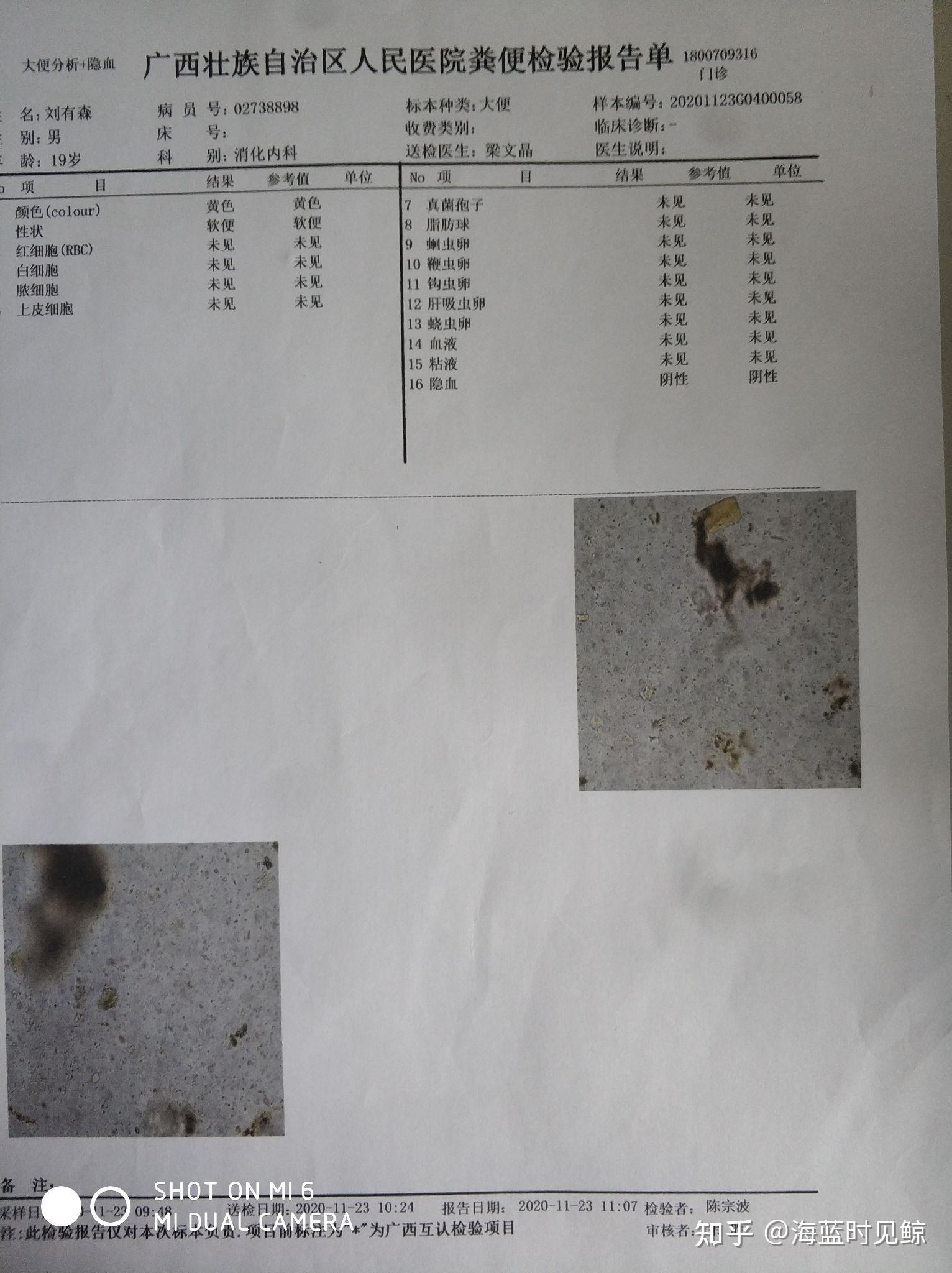 求大家帮帮我我这种属于肛窦炎吗