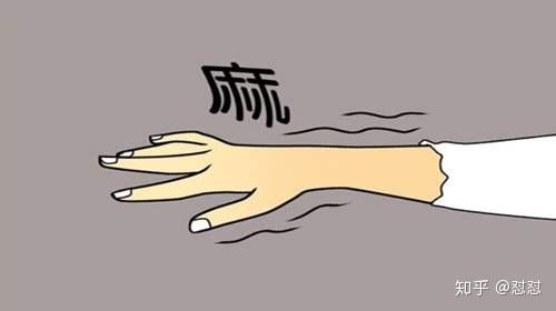 手指麻木,严重时会有疼痛.范围是拇指侧3个半手指.